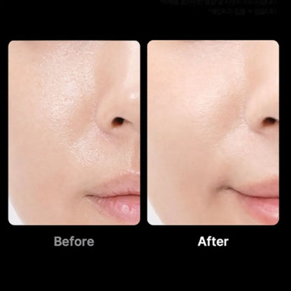 Visible before and after results using Medicube Booster Pro Special Edition showing improved skin firmness, brightness, and reduced fine lines
