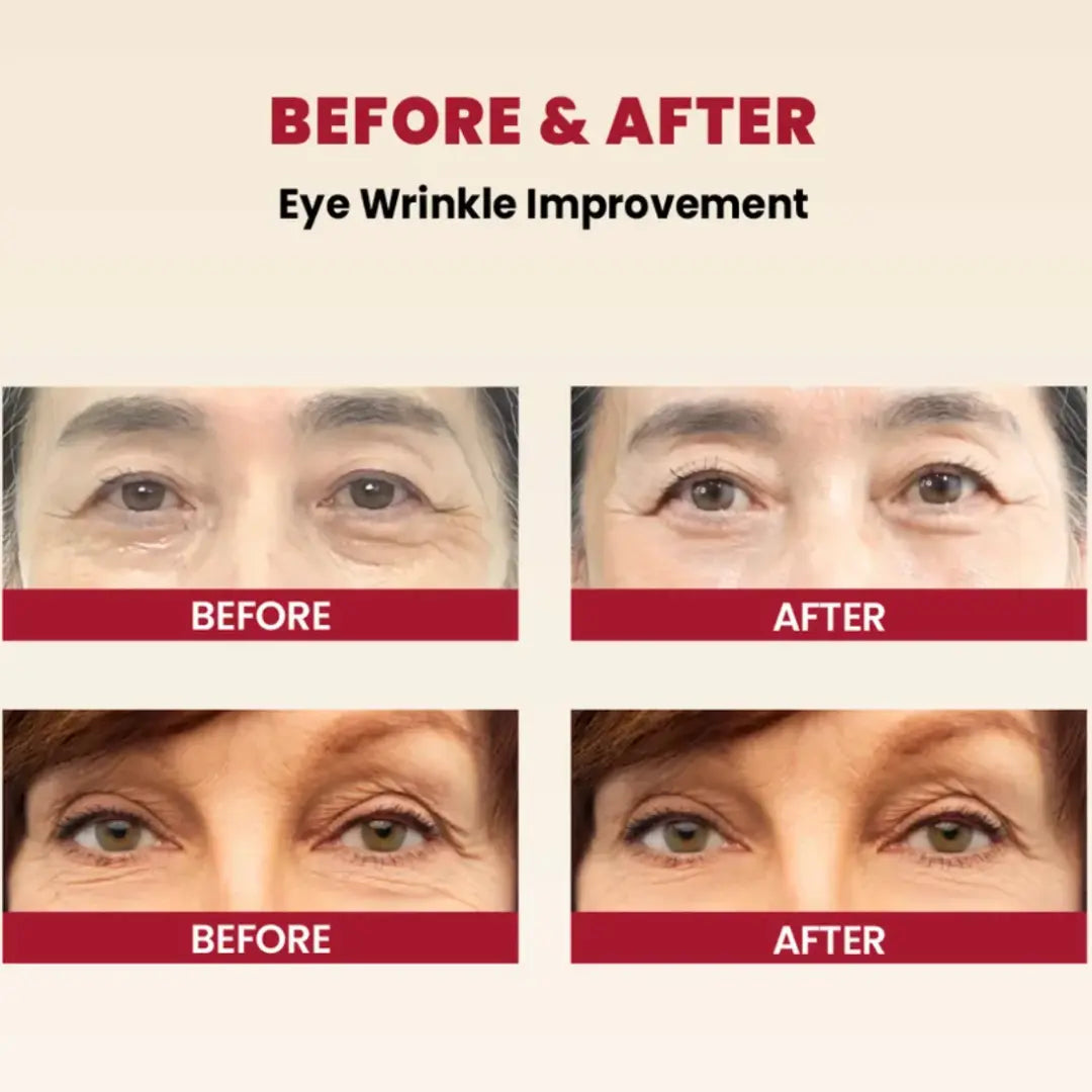 Applying KSECRET SEOUL 1988 Eye Cream around the eye area.